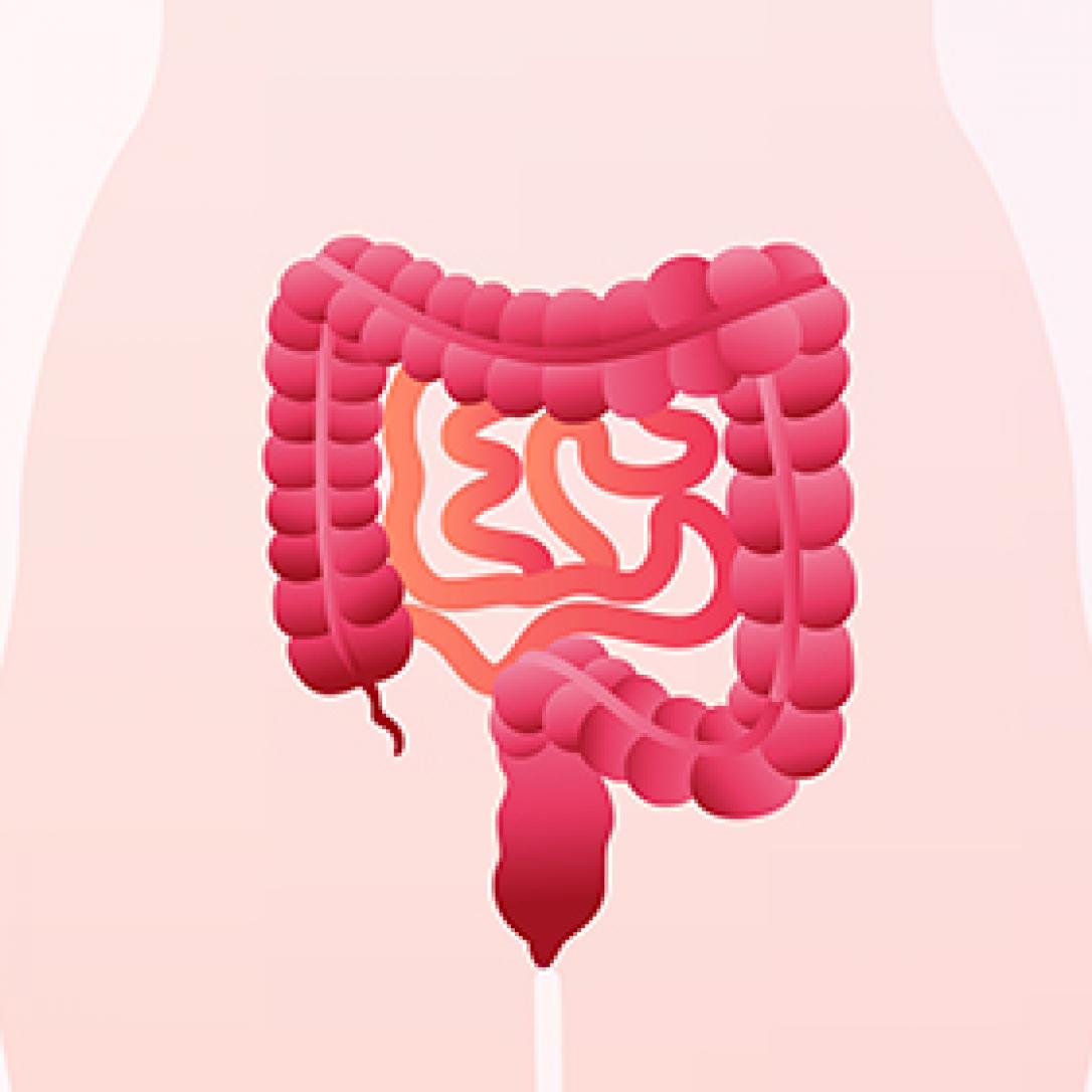 Crohn Hastalığı